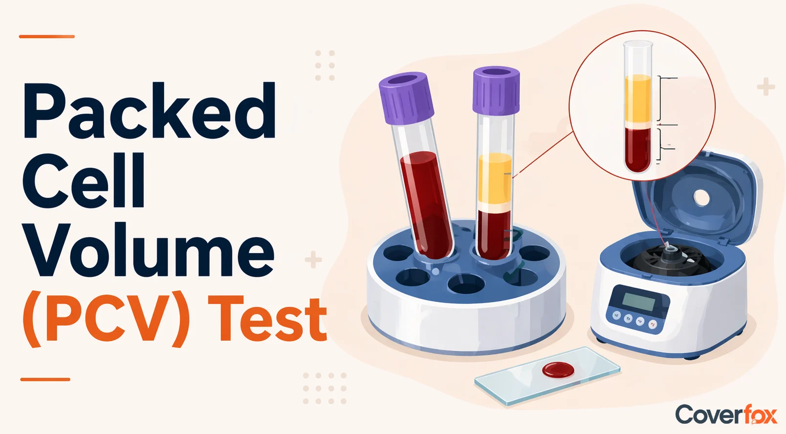 Packed Cell Volume (PCV) Test