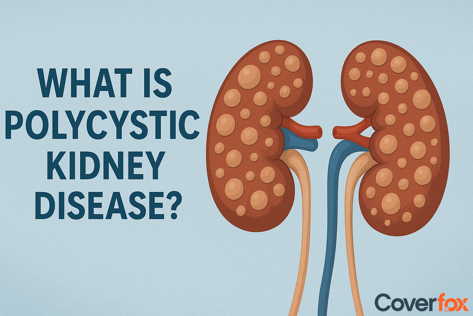 Polycystic Kidney Disease