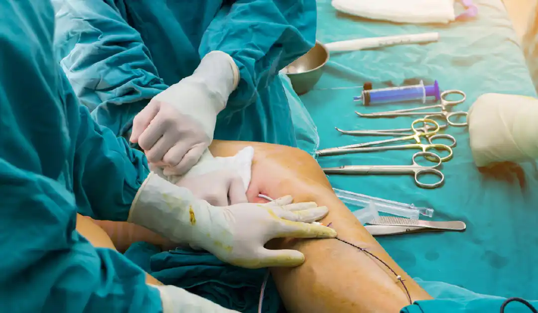 orthopedic surgery covered by health insurance plan

